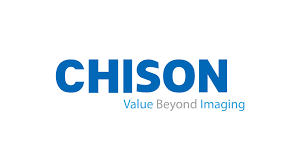 CHISON
